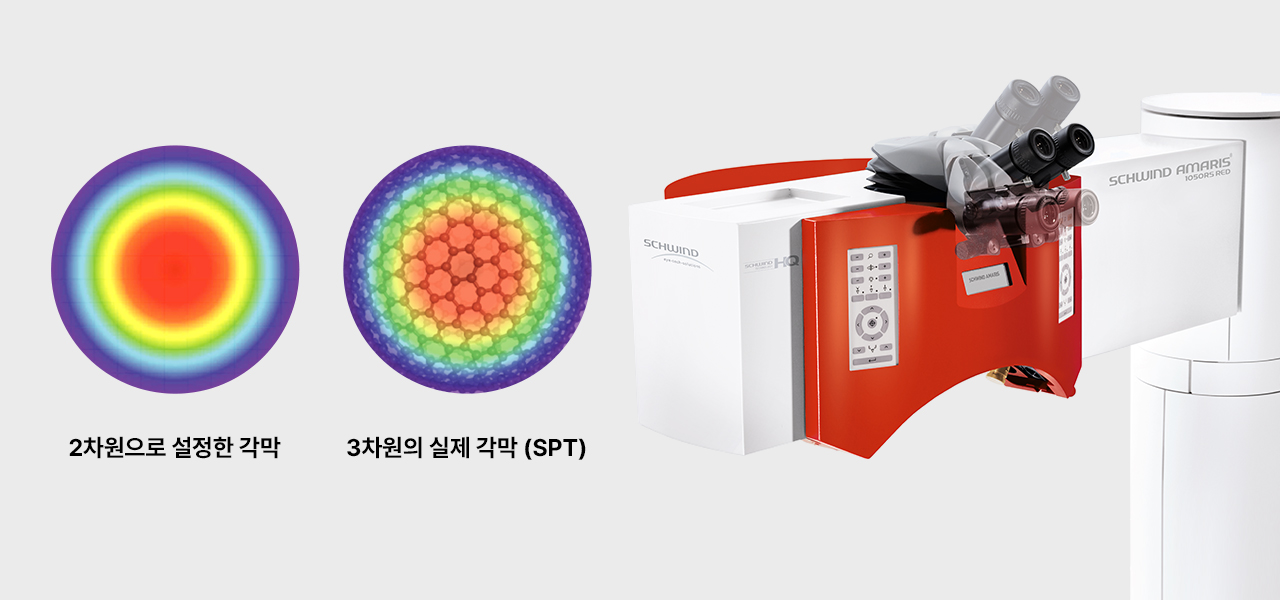 2차원으로 설정한 각막과 3차원의 실제 각막(SPT)을 나란히 보여주는 도해와 아마리스 레드 장비