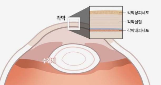 각막 단면에서 각막상피세포·각막실질·각막내피세포 위치를 나타낸 그래픽